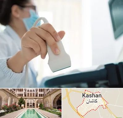 اکوی قلب در کاشان