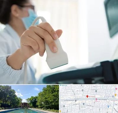 اکوی قلب در هشت بهشت اصفهان