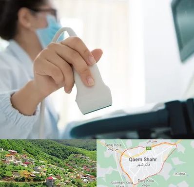 اکوی قلب در قائم شهر