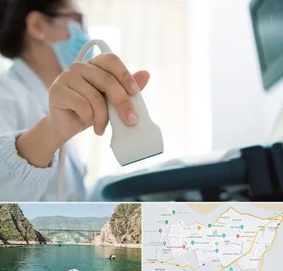 اکوی قلب در ایلام