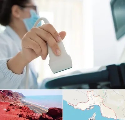 اکوی قلب در هرمزگان