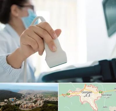 اکوی قلب در گرگان