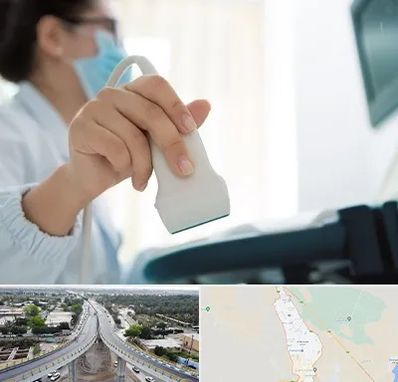 اکوی قلب در اندیمشک