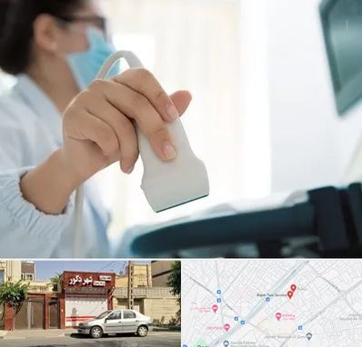 اکوی قلب در باجک قم