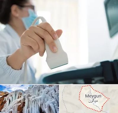 اکوی قلب در میگون