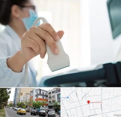 اکوی قلب در هفده شهریور تبریز