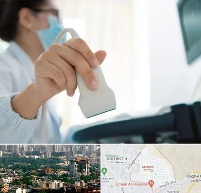 اکوی قلب در عظیمیه کرج 