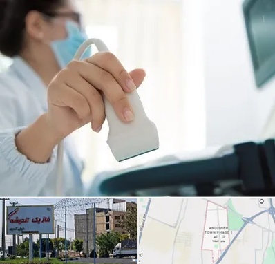 اکوی قلب در فاز یک اندیشه