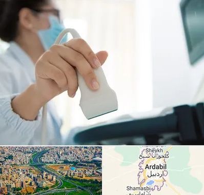 اکوی قلب در اردبیل