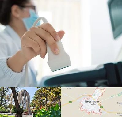 اکوی قلب در نیشابور