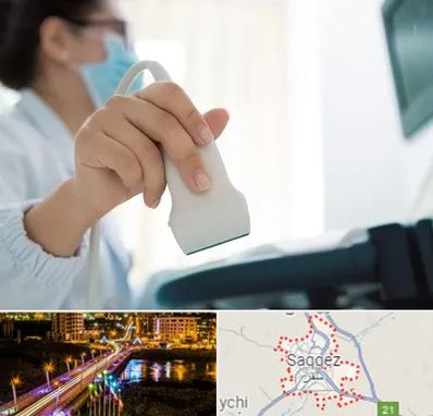 اکوی قلب در سقز