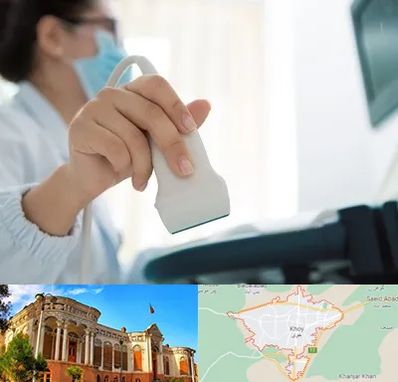 اکوی قلب در خوی