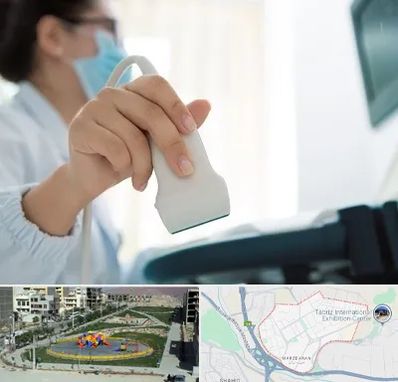 اکوی قلب در مرزداران تبریز