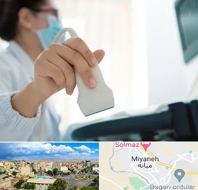 اکوی قلب در میانه