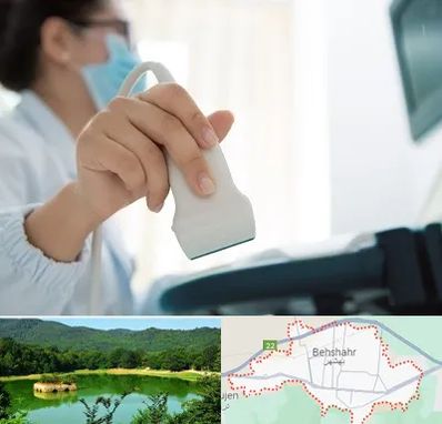 اکوی قلب در بهشهر