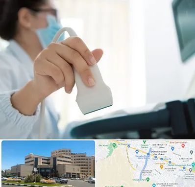 اکوی قلب در صیاد شیرازی مشهد