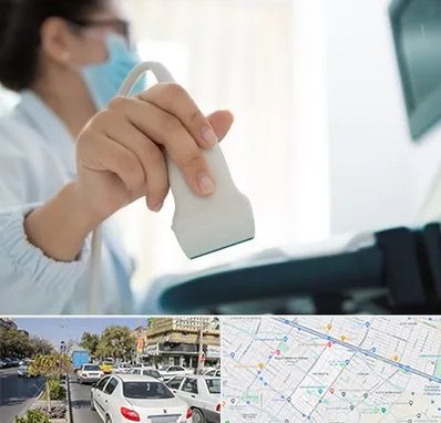 اکوی قلب در مفتح مشهد