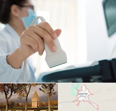 اکوی قلب در تویسرکان