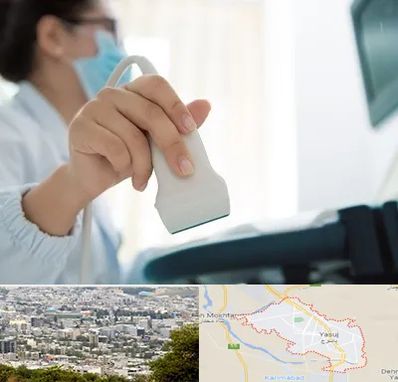 اکوی قلب در یاسوج