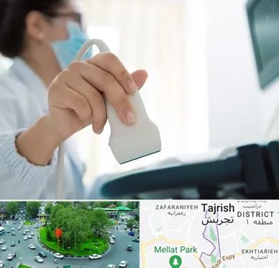 اکوی قلب در تجریش 