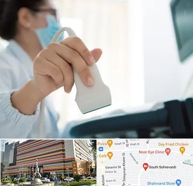 اکوی قلب در سهروردی 