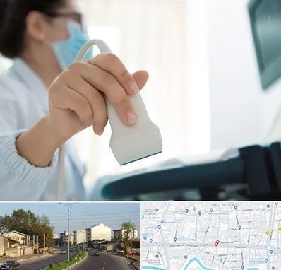 اکوی قلب در ضیابری رشت