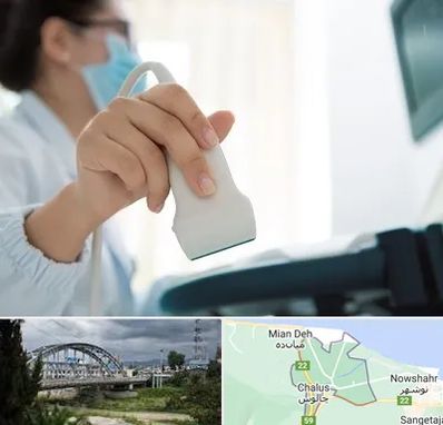 اکوی قلب در چالوس