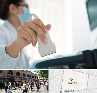 اکوی قلب در بازار تهران