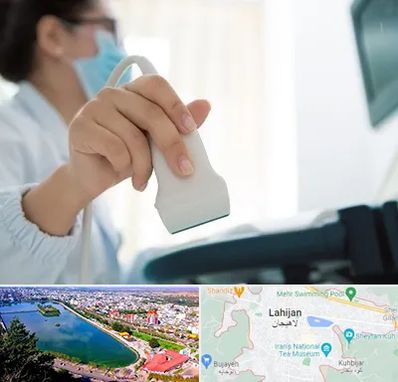 اکوی قلب در لاهیجان