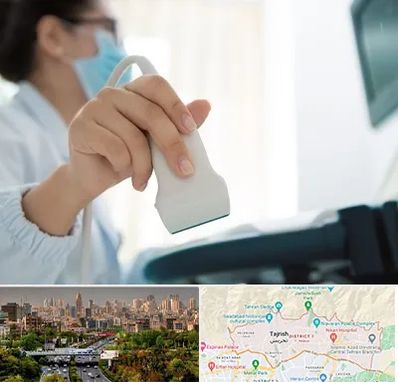 اکوی قلب در منطقه 1 تهران 