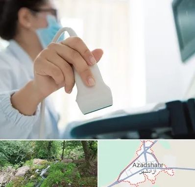 اکوی قلب در آزادشهر