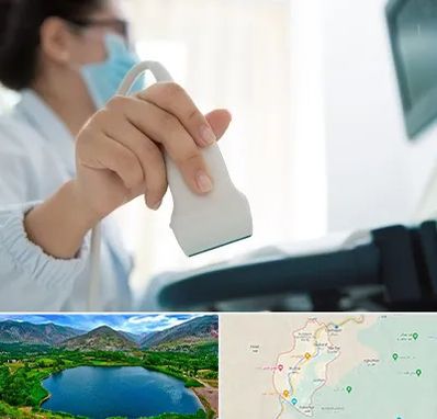 اکوی قلب در رودبار