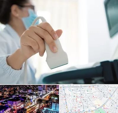 اکوی قلب در منظریه رشت