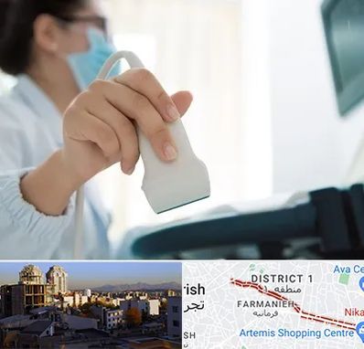 اکوی قلب در فرمانیه 