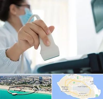 اکوی قلب در کیش