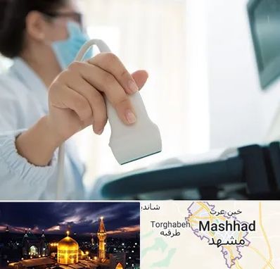 اکوی قلب در مشهد
