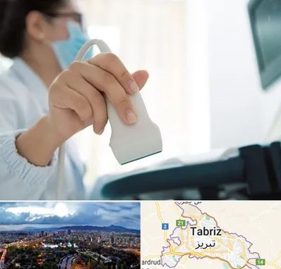 اکوی قلب در تبریز