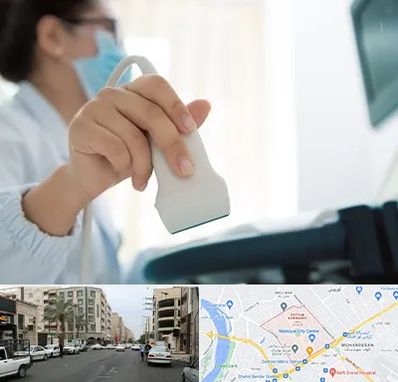 اکوی قلب در زیتون کارمندی اهواز