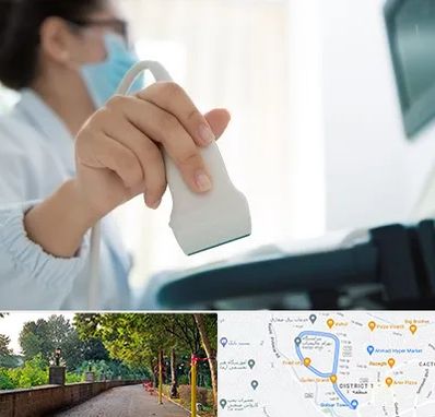 اکوی قلب در بلوار گیلان رشت