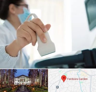 اکوی قلب در باغ فردوس