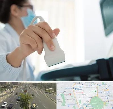 اکوی قلب در منطقه 17 تهران 