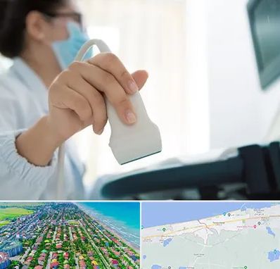 اکوی قلب در فریدونکنار