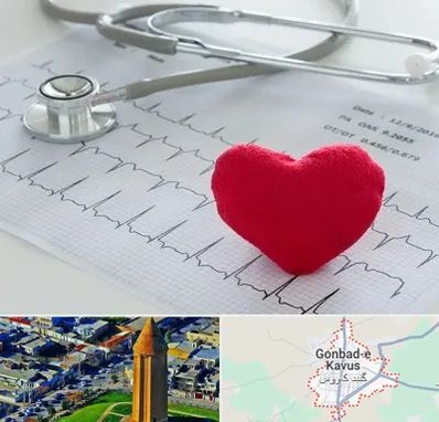 مرکز قلب و عروق در گنبد کاووس