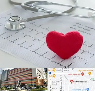 مرکز قلب و عروق در سهروردی 