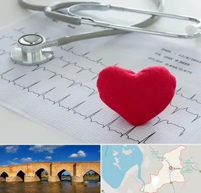 مرکز قلب و عروق در بناب