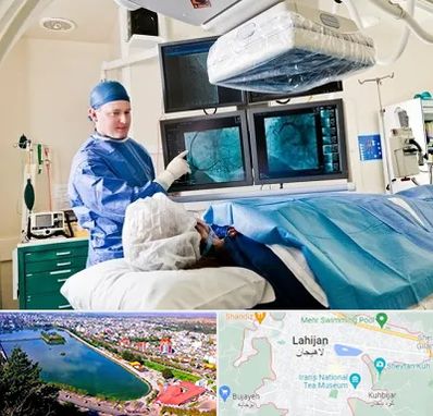 جراح قلب و عروق در لاهیجان