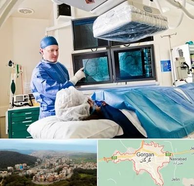 جراح قلب و عروق در گرگان