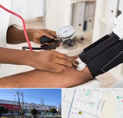 کلینیک فشار خون در فاز دو اندیشه