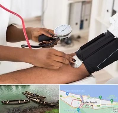 کلینیک فشار خون در بندر انزلی