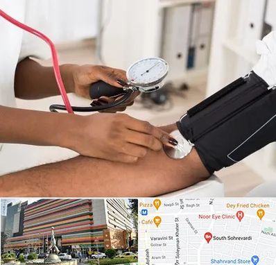 کلینیک فشار خون در سهروردی 